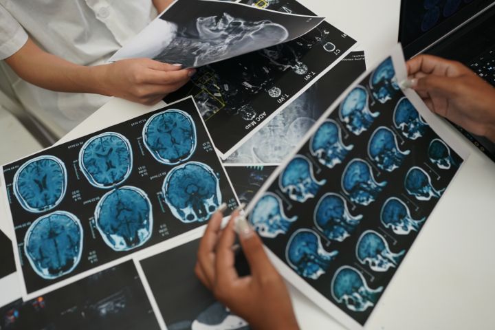 Daño Cerebral Adquirido en el contexto hospitalario